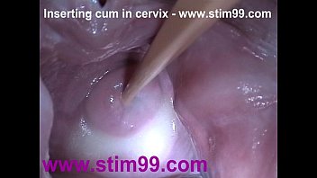 best of With wide cervix stretching