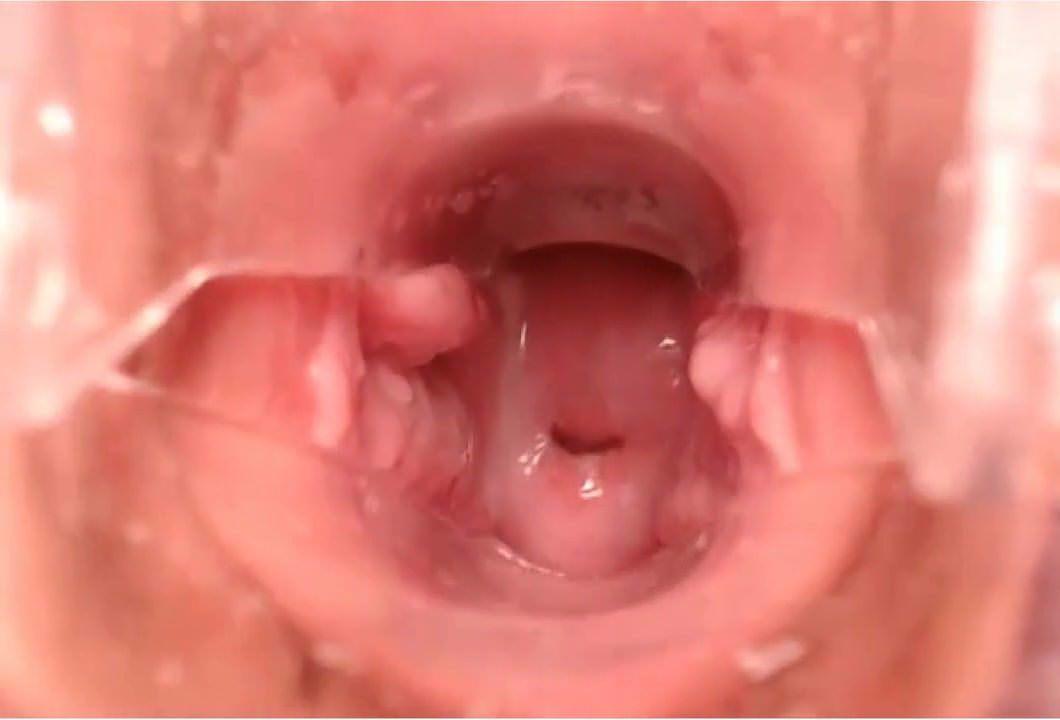 Cervix cumshot