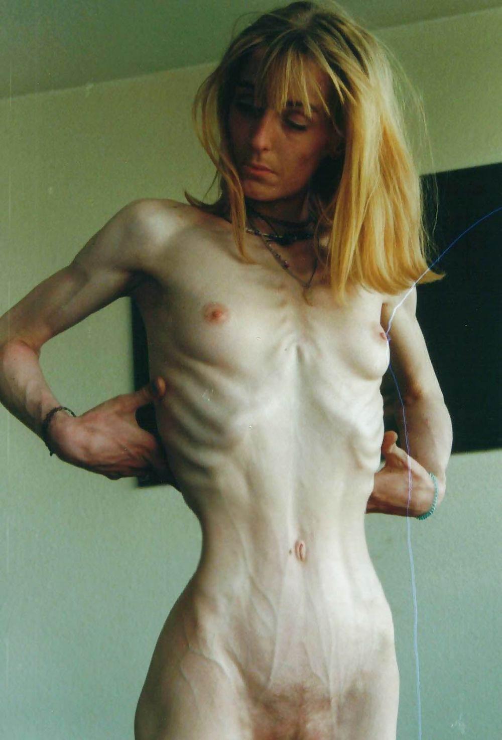 Anorexic tits