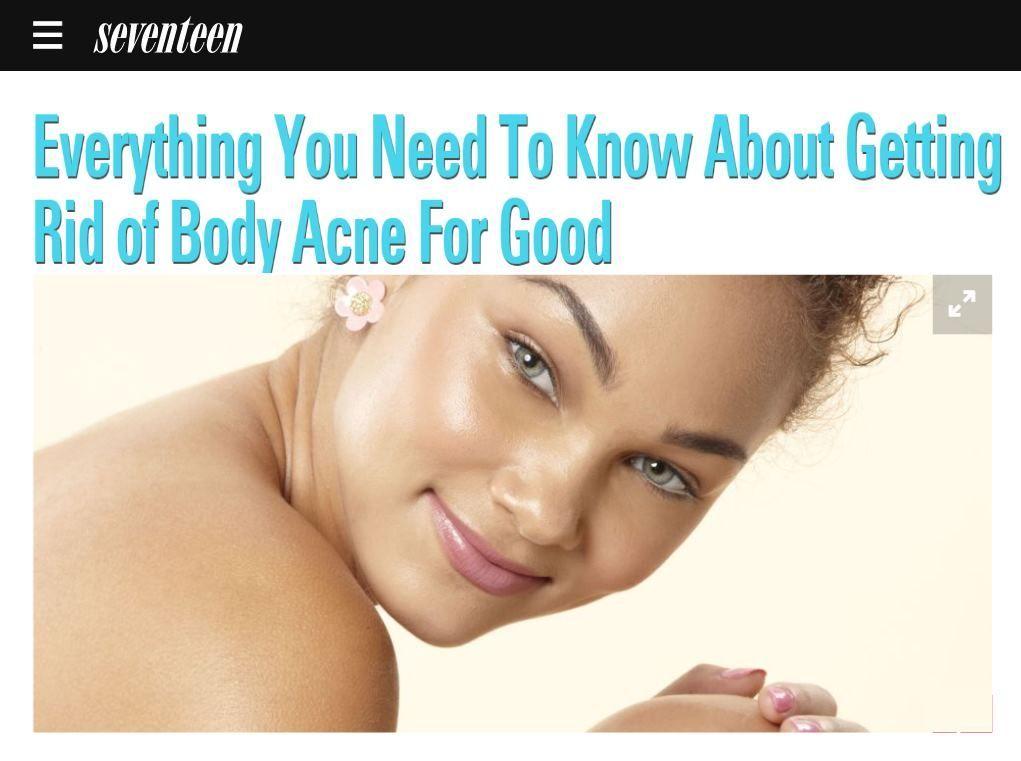 Outlaw reccomend Acne acne body facial harder than treat why