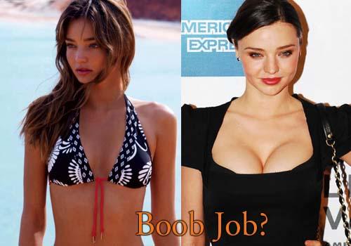 Boob jobs befor afters