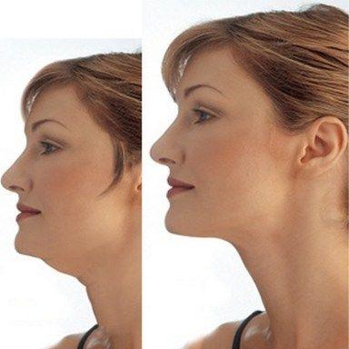 best of Neck for loose Facial skin exercises