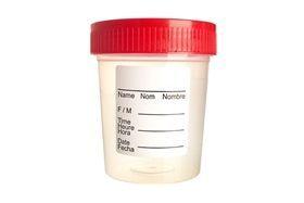 best of Sperm collection cups Sterile