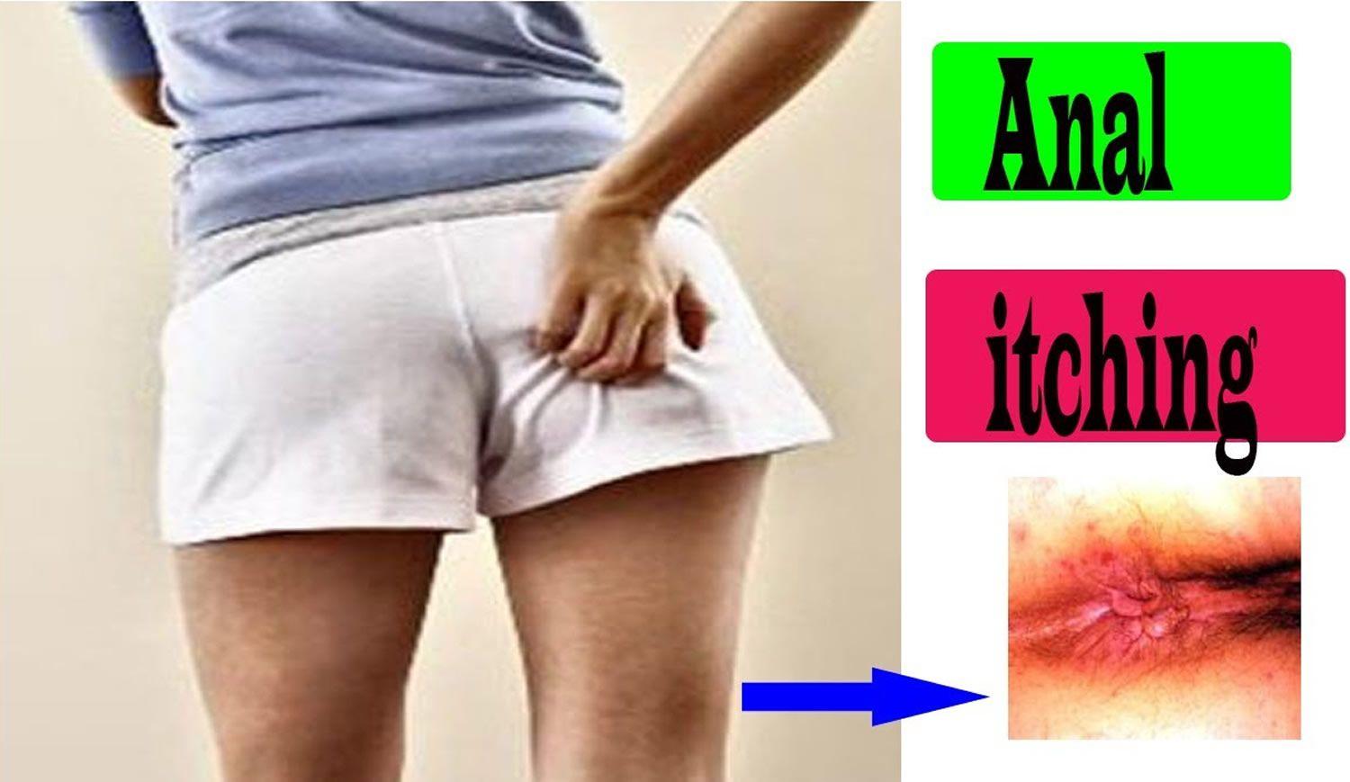 Itchy anus remedy