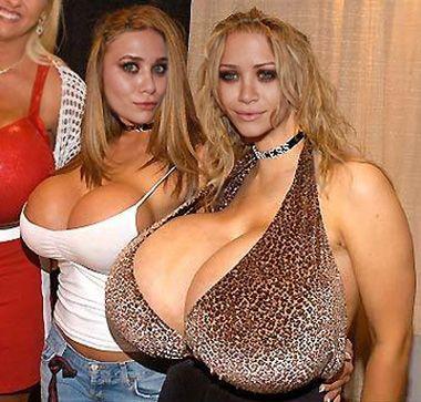 The oslen twins boobs