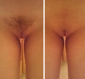 Hairy Shaved Pussy