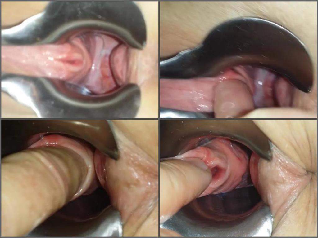 Shift reccomend Urethra penetration clips