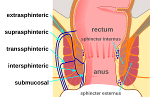 best of Open sphincter tube Anus held