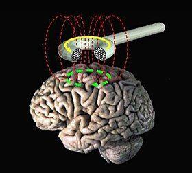 Deep brain penetration for depression