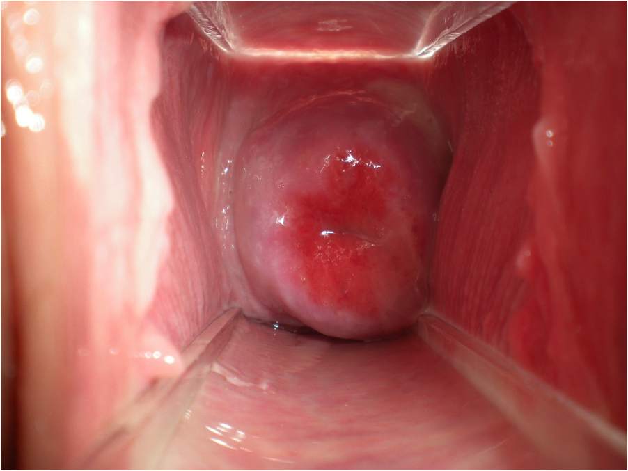 A penis inside a vagina