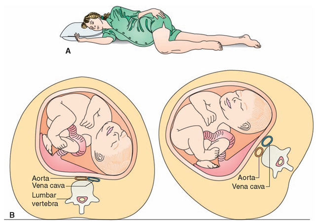 best of Pregnancy position sex image During