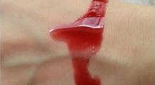 Losing virginity how much blood