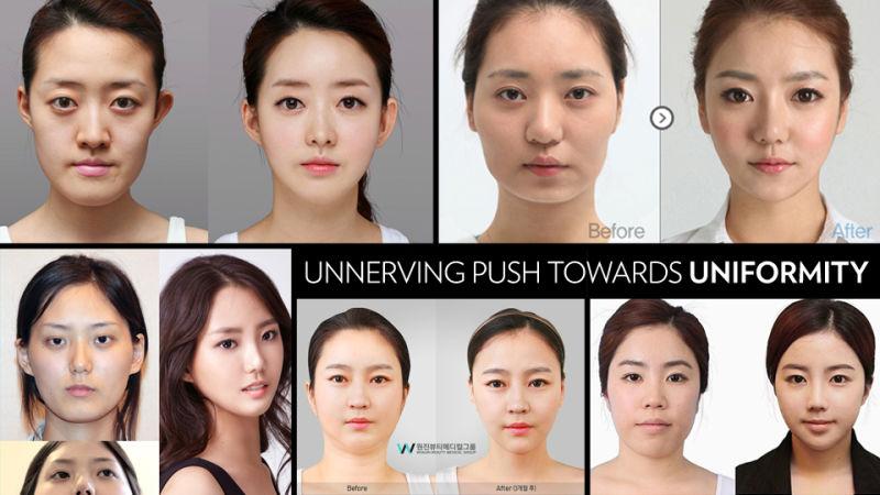 best of Pictures Asian plastic surgery