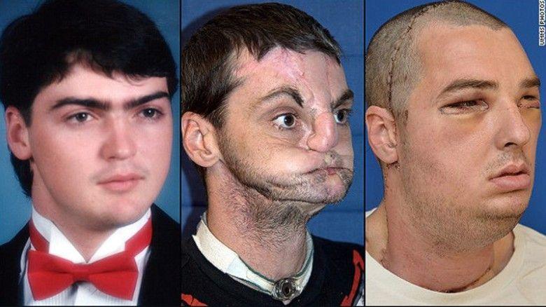 best of Surgery Facial deformity