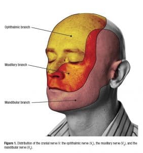 Facial pain treatment