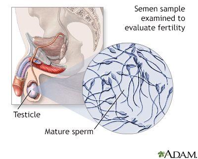 Titanium reccomend Fertility help for women needing sperm
