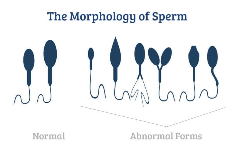 Why is mens sperm differnt
